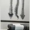 Chiropractic Remedy