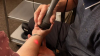 Deep Tissue Laser Therapy